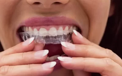 Invisalign Studio City: Clear Aligner Therapy for Discreet Orthodontic Correction